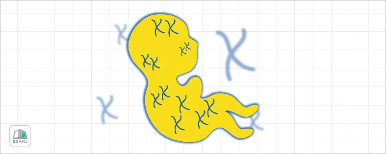 عکس جنین سندروم داون