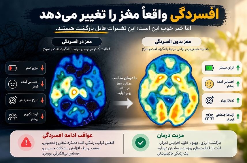 درمان افسردگی