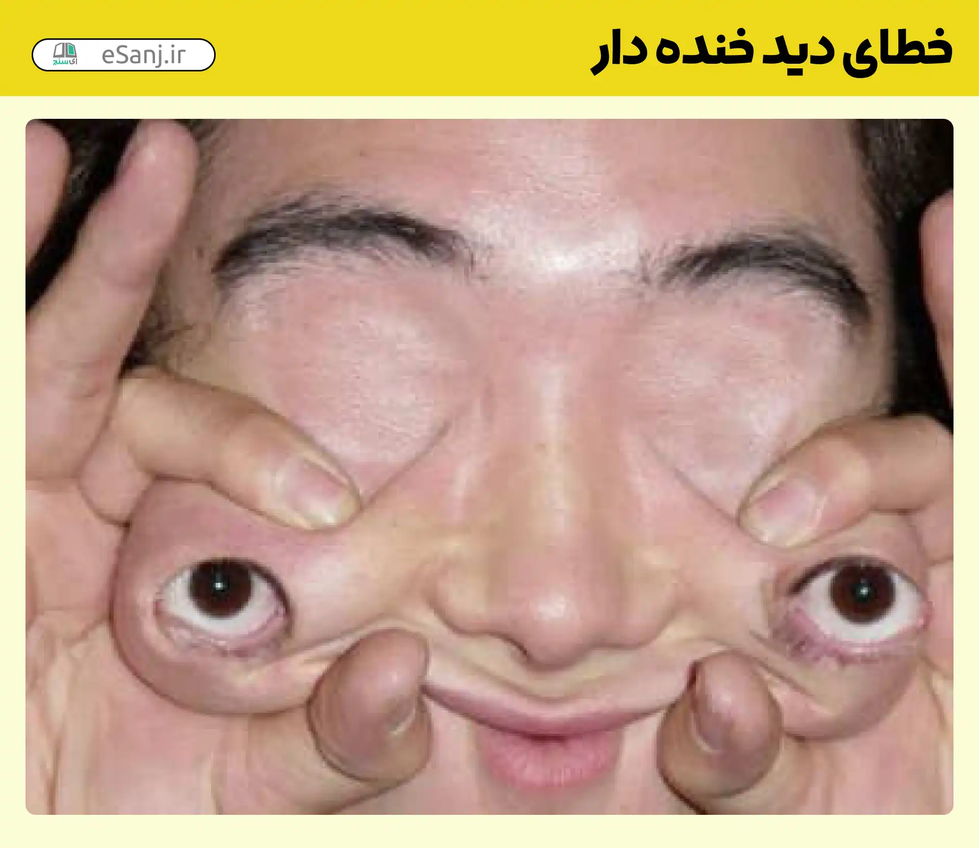 خطای دید خنده دار چهره جمع شده