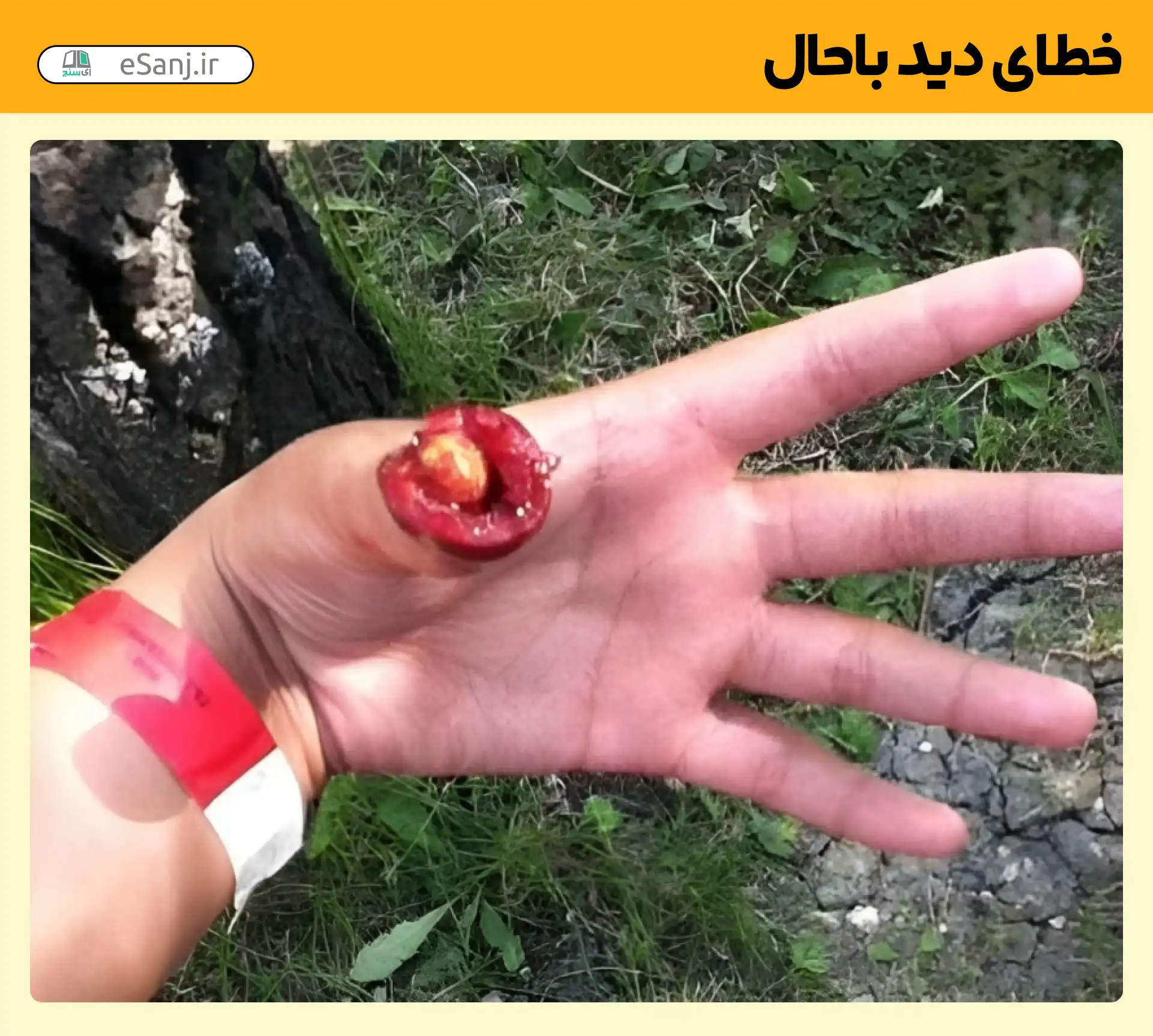 خطای دید باحال انگشت بریده