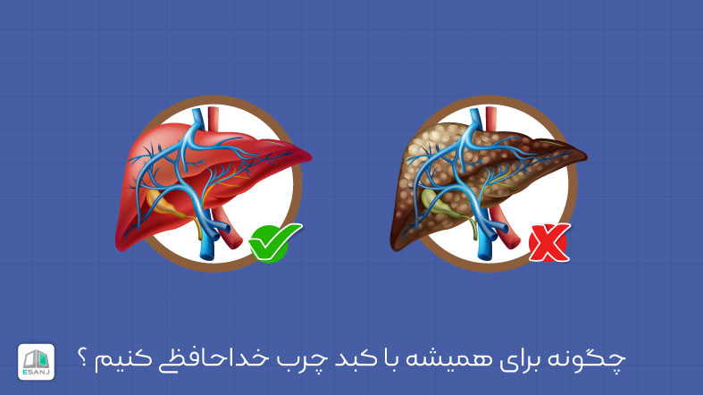 کبد چرب چیست؟ (علت، علائم، تشخیص و درمان)