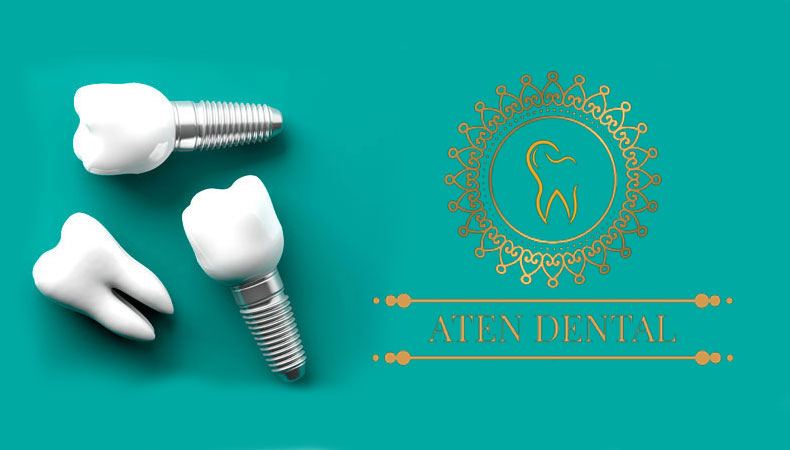 دندانپزشکی اقساطی آتن