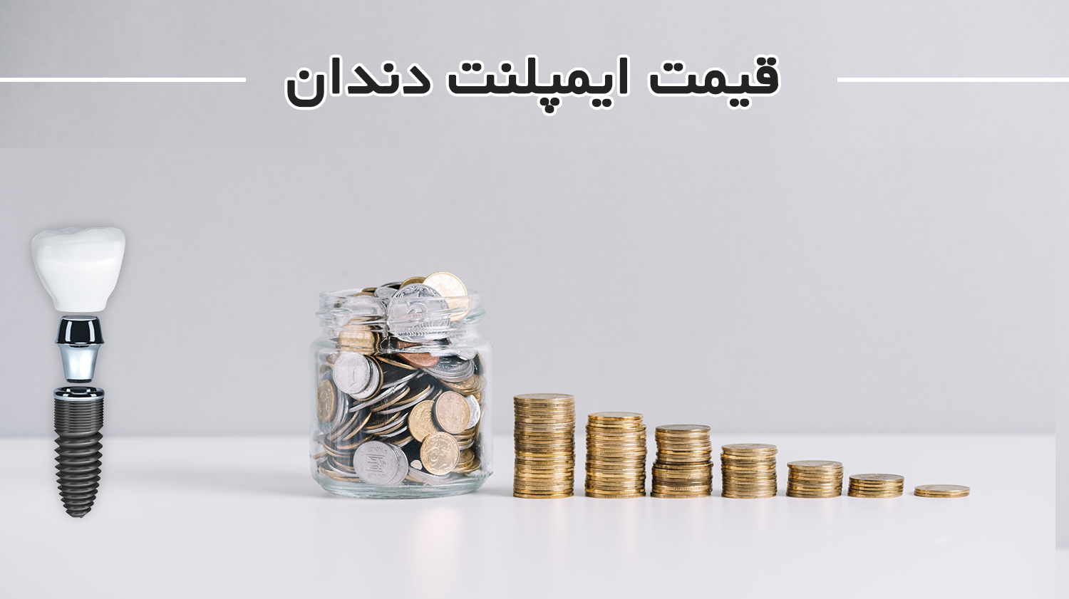 قیمت ایمپلنت دندان در مرکز ایمپلنت تهران