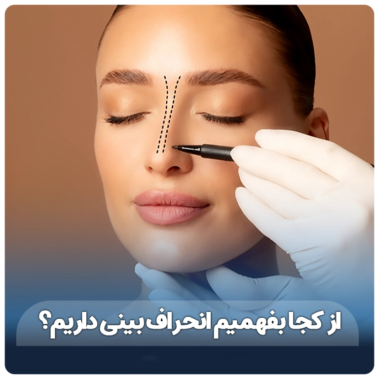 از کجا بفهمیم انحراف بینی داریم؟