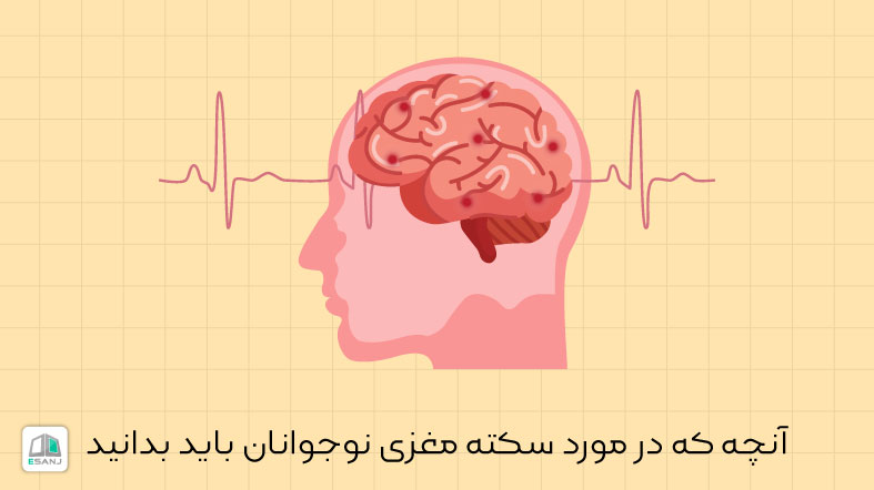 آنچه که در مورد سکته مغزی نوجوانان باید بدانید